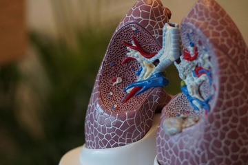 Air pollution fuels lung cancer among non-smokers, reports new medical study