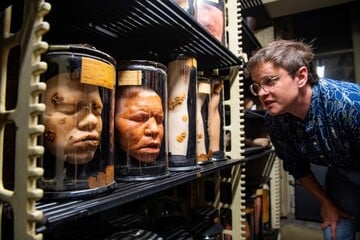 Unnamed skeletons? Philadelphia medical museum becomes center of ethical debate