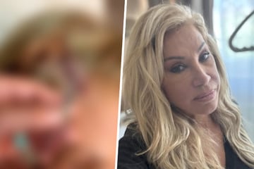 Carmen Geiss: Nichts für schwache Nerven: Carmen Geiss zeigt Horror-Narbe von ihrer Hirn-OP
