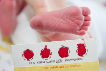 Neugeborenen-Screening rettet Babys das Leben