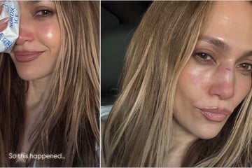 Jennifer Lopez reveals nasty injury from AMAs rehearsals!