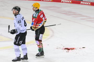 Gesicht aufgeschnitten, Achillessehne durchtrennt: Üble Verletzungen schocken DEL
