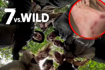 Verletzungs-Drama bei "7 vs. Wild": Kandidat kämpft mit eiternden Wunden – Droht das Aus?