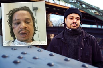 Markus wird von Gruppe fast totgeprügelt: "Mir wurde ins Gesicht getreten, war ein Stampfen"