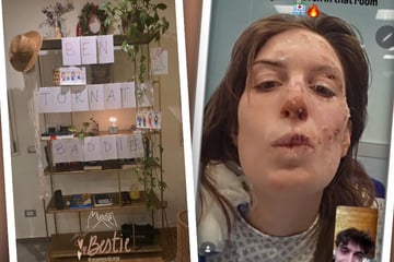 Überlebende von Crans-Montana darf Klinik verlassen, doch geheilt ist sie noch nicht