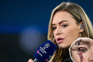 Bei Unfall schwer verletzt: Beliebte Fußball-Moderatorin zeigt ihre Horror-Wunden