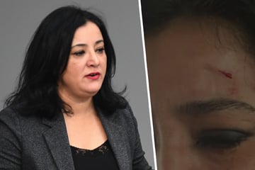 Attacke in Zug: Linken-Politikerin bekommt Flasche an den Kopf!