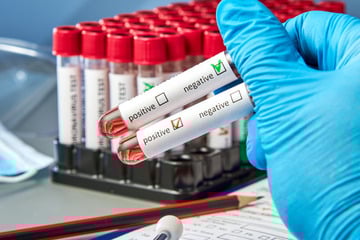 HIV und andere sexuell übertragbare Infektionen in Hessen: So ist der aktuelle Stand