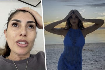 Yeliz Koc: Yeliz Koc spricht offen über ihre Brust-OP: "Ich bereue das schon"