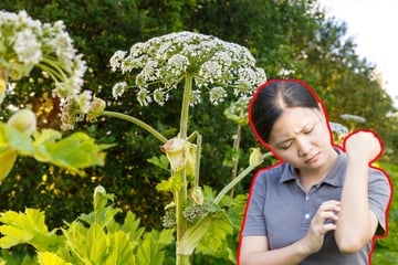 Juckender Ausschlag nach der Gartenarbeit? Achtung, das sind phototoxische Pflanzen