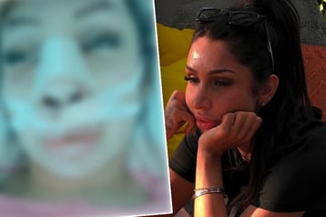 Nichts für schwache Nerven! Realitystar Pinar Sevim spricht nach Schönheits-OP von "Todesschmerzen"