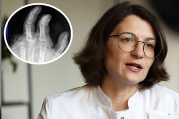 Berlin: Abgetrennte Finger und Amputationen: So erlebt eine Handchirurgin die Silvesternacht