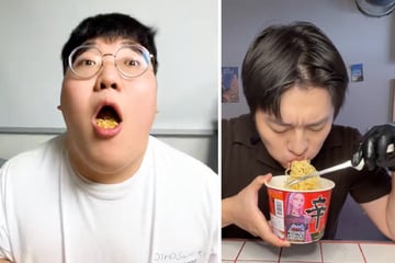 Verbrennungen wegen TikTok-Trend: Ärzte schlagen Alarm