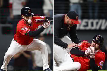 Guardians star David Fry suffers brutal face injury after being hit with 99-mph pitch