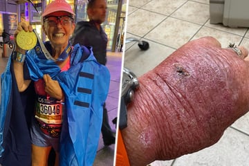 Autsch! Kleiner Schnitt am Karton endet für Frau im Krankenhaus