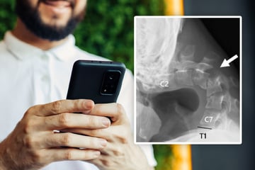 Mann starrt ständig auf sein Handy: Dann entwickelt er eine gefährliche Krankheit