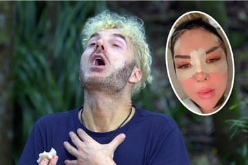 "Ich dachte, das ist KI!": Reality-Star schockiert von Emma Fernlunds Dreifach-OP