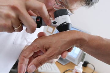 Hautärztemangel in Sachsen immer schlimmer