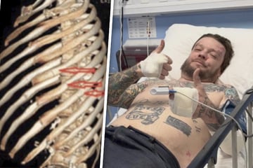 Reality-Star hat üblen Motorrad-Unfall: Rippen gebrochen, Hochzeit futsch