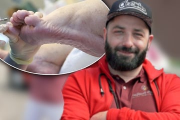 "Jobtester" am Limit: TikTok-Star Dr. Emkus kämpft mit seiner Fuß-Phobie