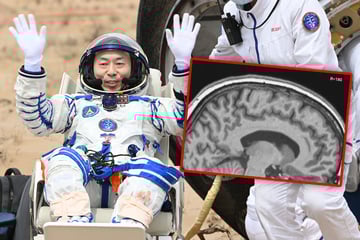 Neue Erkenntnisse: Weltraumflüge verschieben das Gehirn