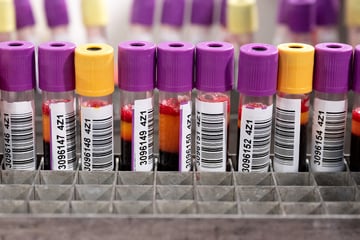 Blutkonserven gefragt: Wo Ihr in Köln im Herbst Blut spenden könnt