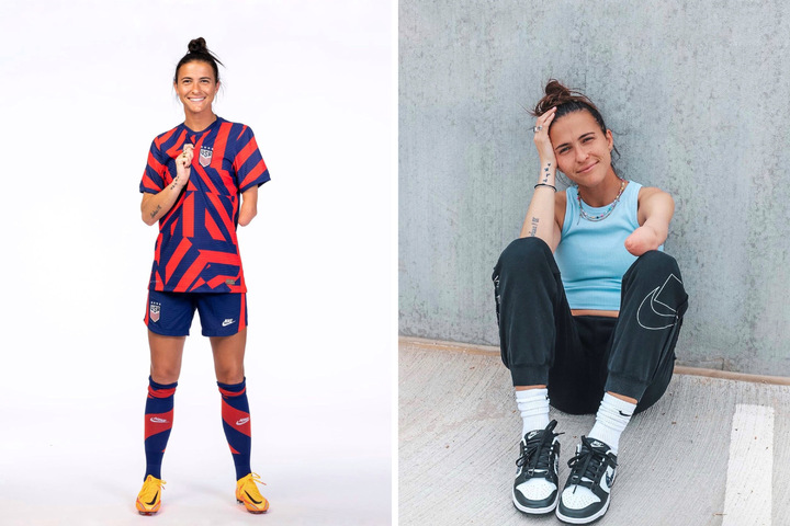 Carson Pickett Becomes First Uswnt Player With A Limb Difference 