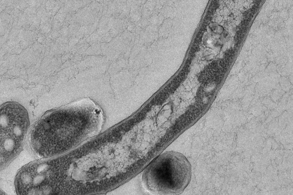 Tuberkolose gilt als eine der tödlichsten Krankheiten der Welt.