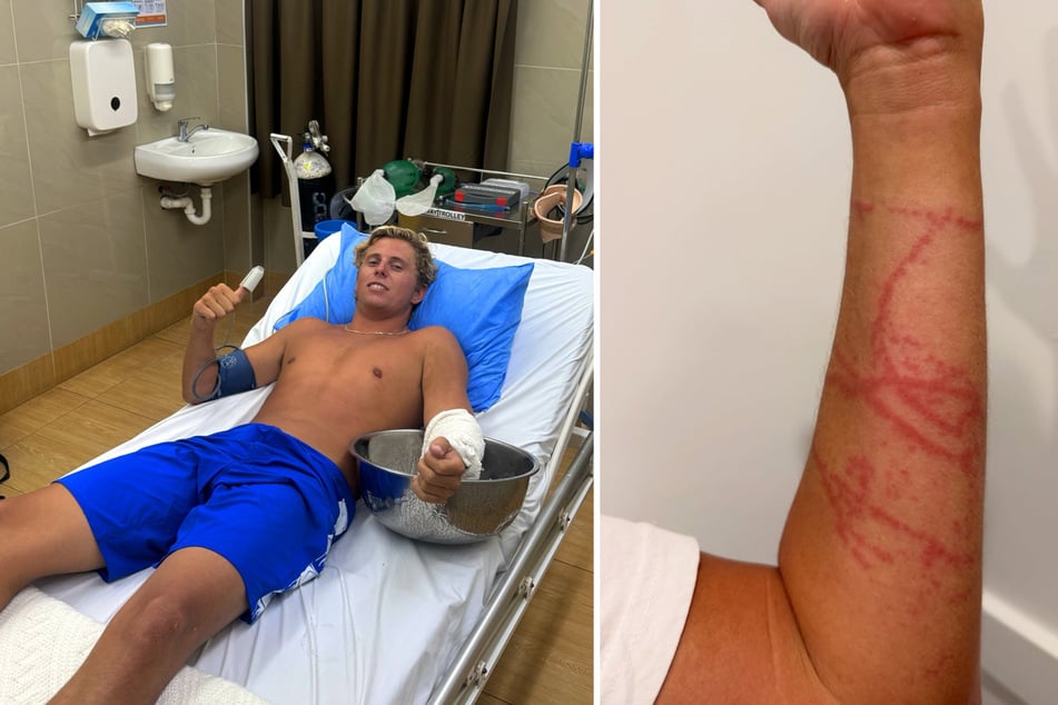Der Stich, der sich über die Hälfte seines Arms erstreckte, galt als lebensbedrohlich.