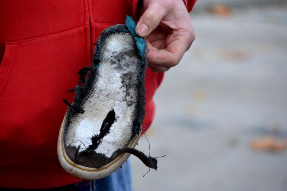 "Boah, der ganze Schuh ist weg": Was bei einer Böller-Explosion schiefgehen kann, wurde am "Tag des brandverletzten Kindes" gezeigt.