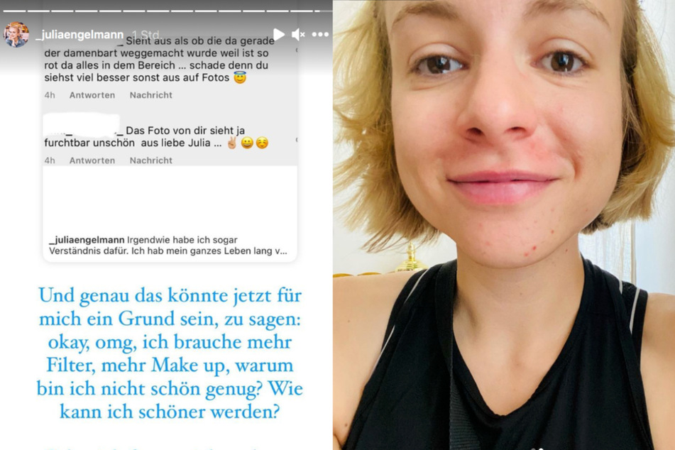 Poetry-Slammerin Julia Engelmann wird für emotionales Selfie angefeindet und reagiert genial