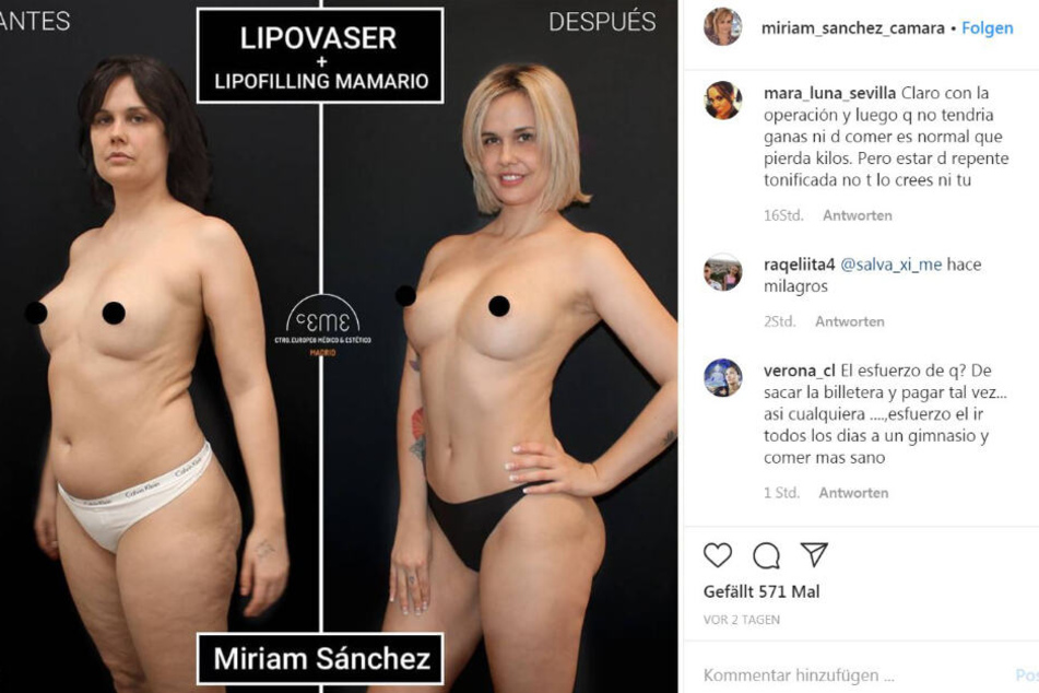 Vorher und nachher: Miriam Sánchez Cámara machte eine regelrechte Verwandlung durch.