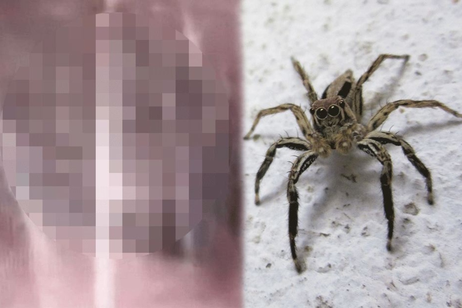 Arzt Findet Spinne In Ohr Von Mann Doch Es Wird Noch Viel Ekliger 24