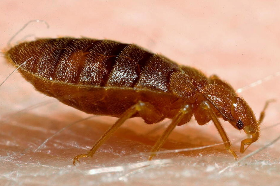 Eine Bettwanze beim Blutsaugen auf menschlicher Haut, veröffentlicht von der Harvard Universität (Foto undatiert).
