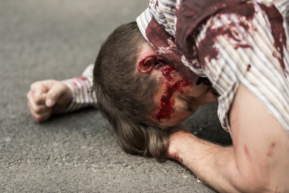Der 42-Jährige erlitt bei dem Angriff schwere Kopfverletzungen. (Symbolbild)