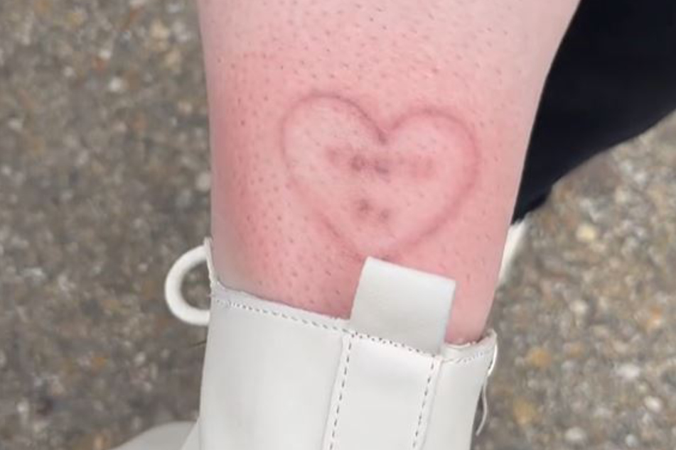 So sieht das Tattoo von Katherine (27) mittlerweile aus.