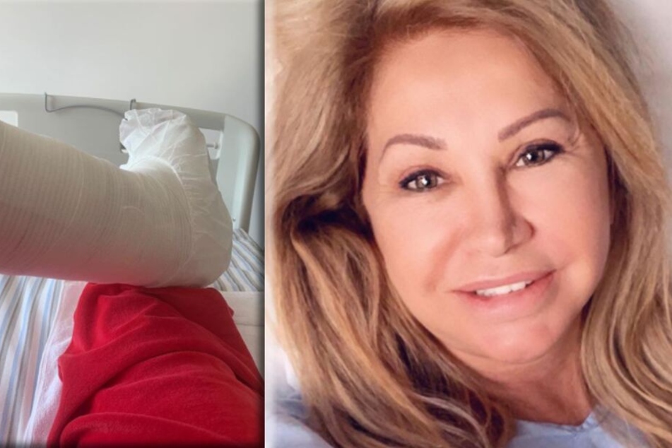 Carmen Geiss (53) trägt nach der Fuß-Op am Freitag vorerst noch Gips.