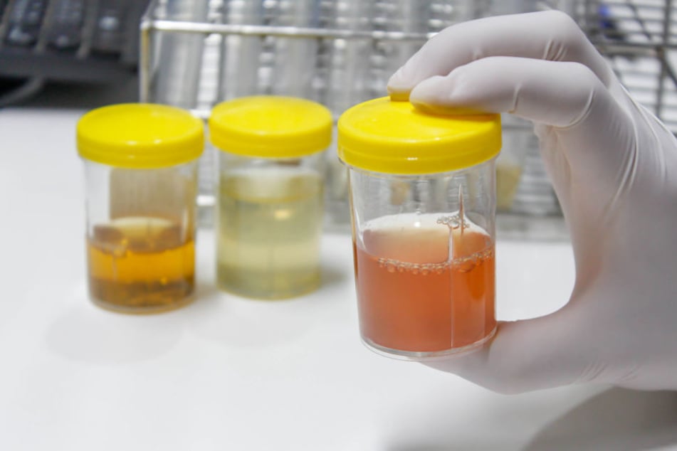 Im Labor werden Urinproben auf mögliche Erkrankungen untersucht.