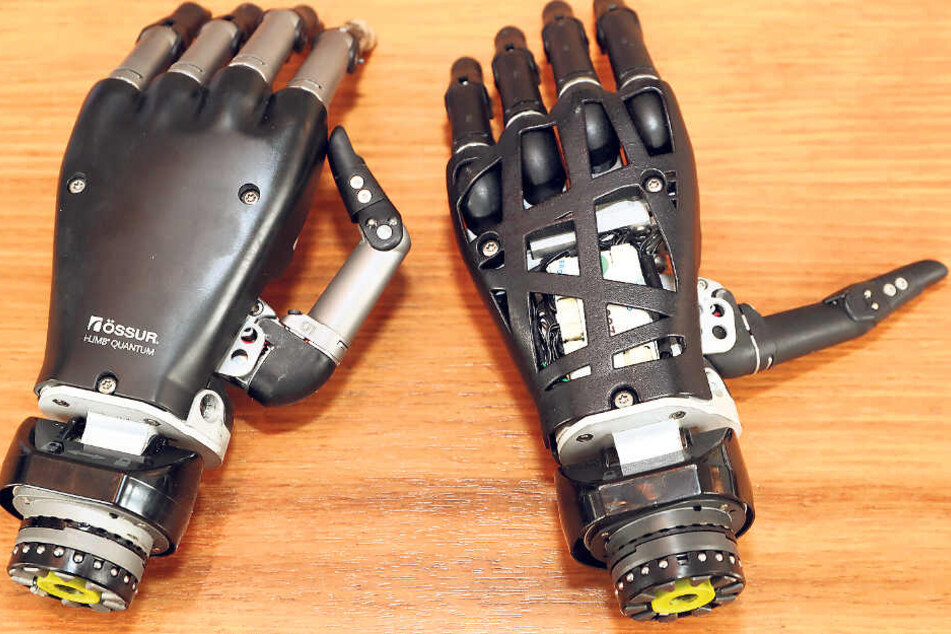 Ein Wunderwerk der Technik! Etwa 30 000 Euro kostet so eine Hand. Die modernste Hand und das Vorgängermodell: Professor Meyer hat sie beide schon getestet.