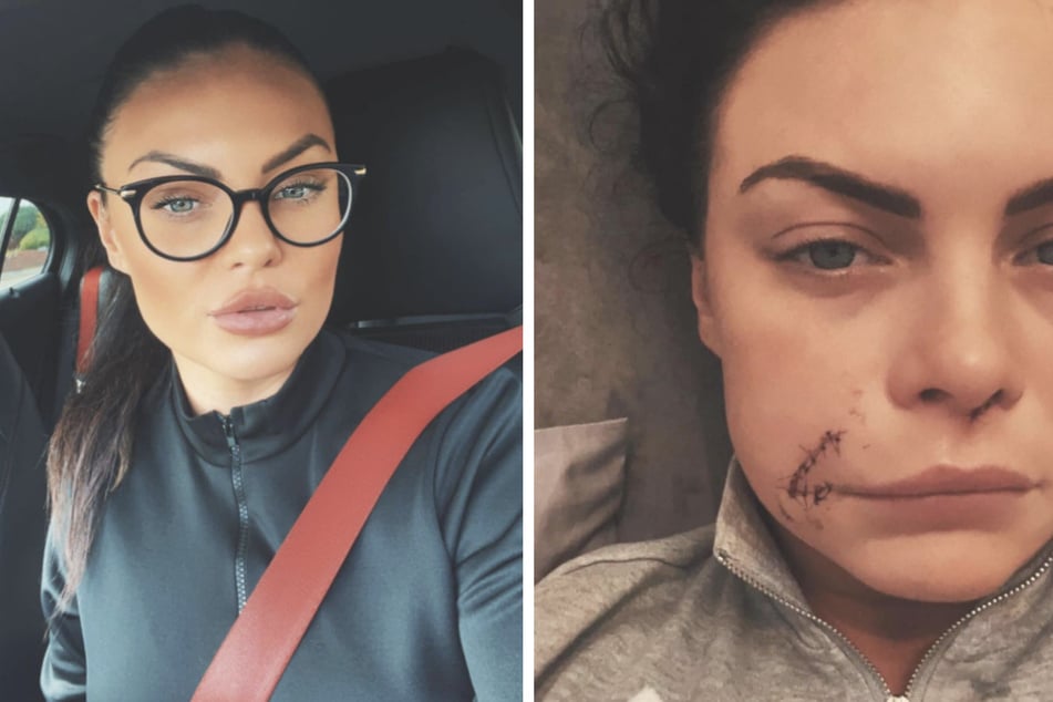 Kelsea Morgan (33) wurde urplötzlich vom Hund eines Freundes attackiert.