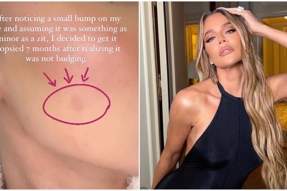 Khloé Kardashian dropped a surprising health bombshell that no one saw coming!