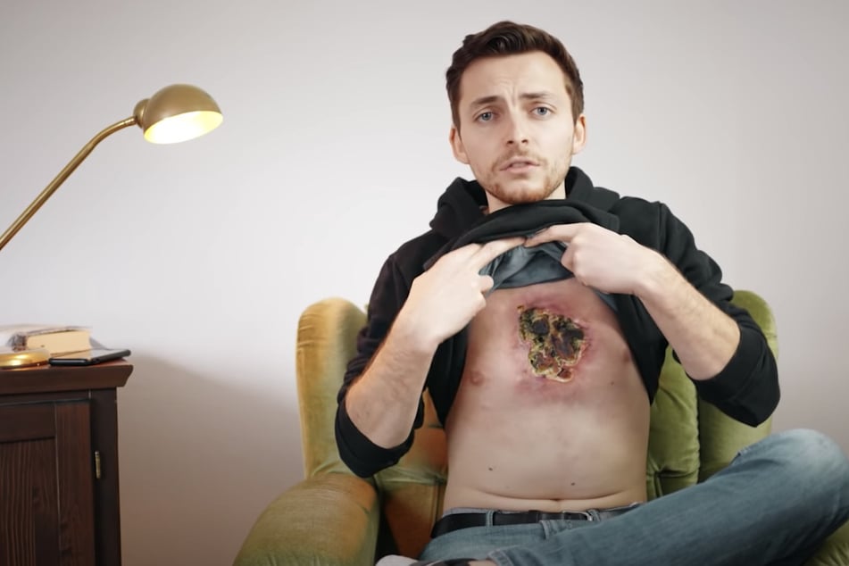 YouTuber Philipp Mickenbecker (23) ist an Lymphdrüsenkrebs erkrankt.