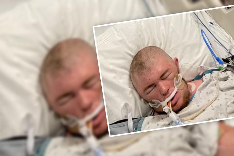 Ohio man wakes from coma after getting stung 20,000 times by bees