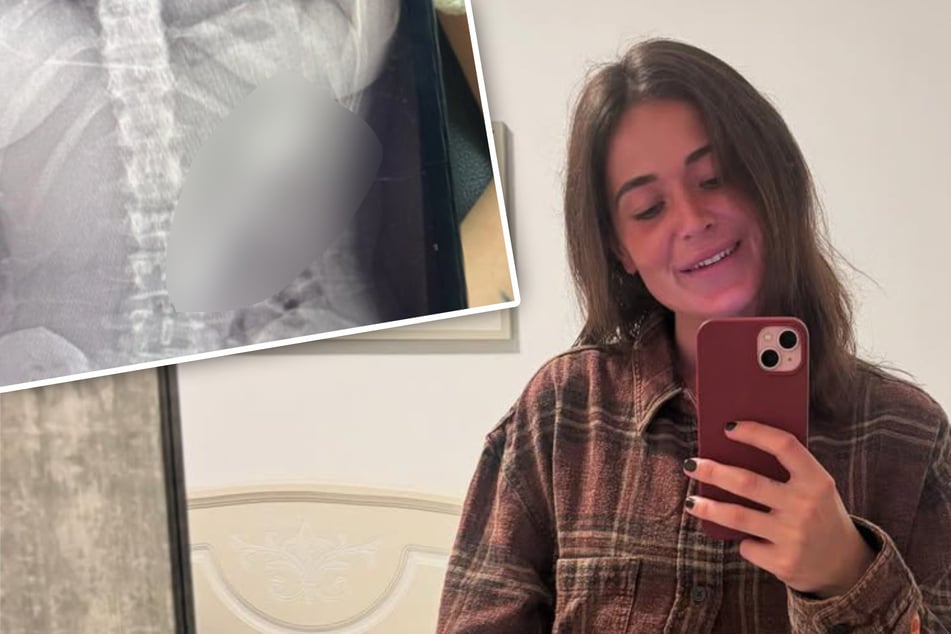 Frau isst Joghurt, als Hund auf sie springt: Was dann passiert, entsetzt so viele