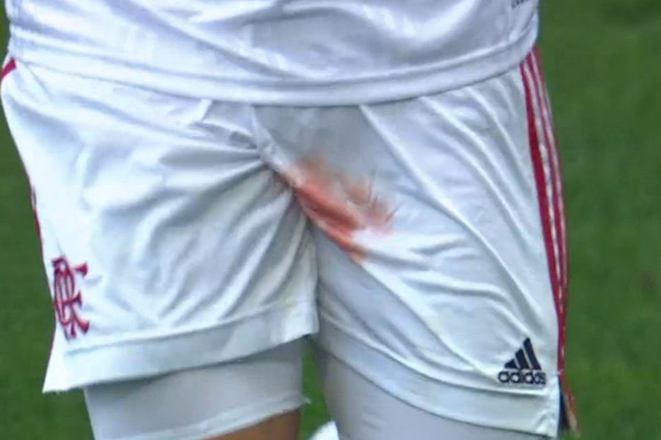 So ein Bild möchte man beim Fußball auf keinen Fall sehen: Gustavo Henrique (27) muss mit Blut im Schritt den Platz verlassen.