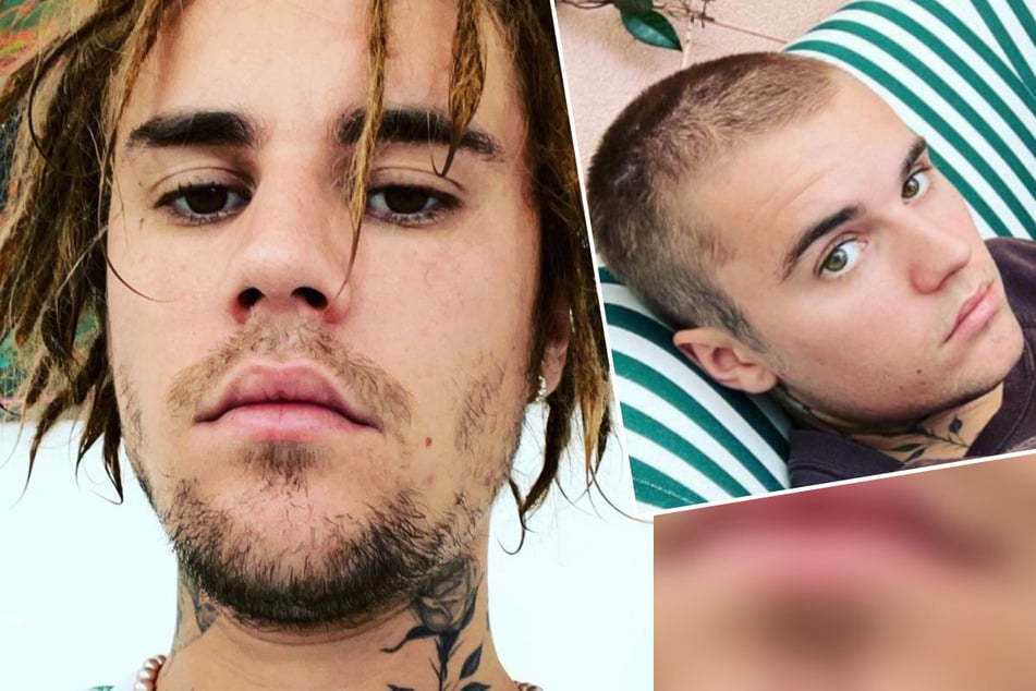 Singer Justin Bieber (27) caused a lot of criticism with his dreadlocks (l.), but he has now said goodbye to them.