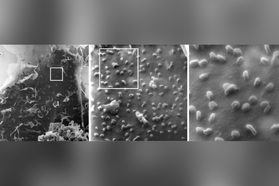 Eine mit SARS-CoV-2-infizierte Nierenzelle unter dem Heliumionen-Mikroskop (ausschnittsweise Vergrößerung von links nach rechts, ein einzelnes Virus ist etwa 100 Nanometer groß): Die Aufnahmen weisen darauf hin, dass manche Coronaviren beim Austritt aus der Zelle nur lose aufliegen, während andere Viren an die Zelle gebunden sind.