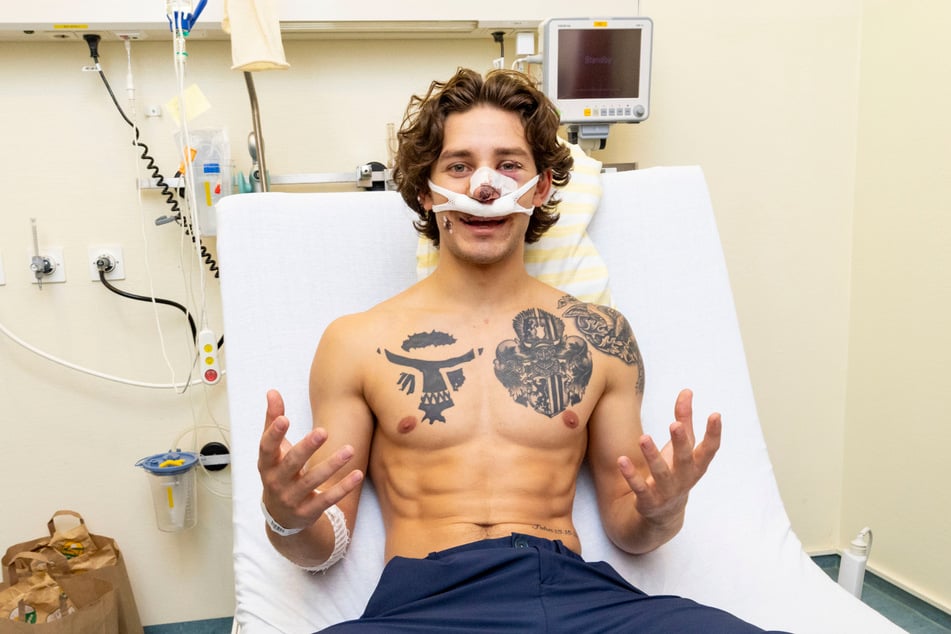 John Rudats (20) Gesicht ist von der brutalen Messerattacke schwer gezeichnet.