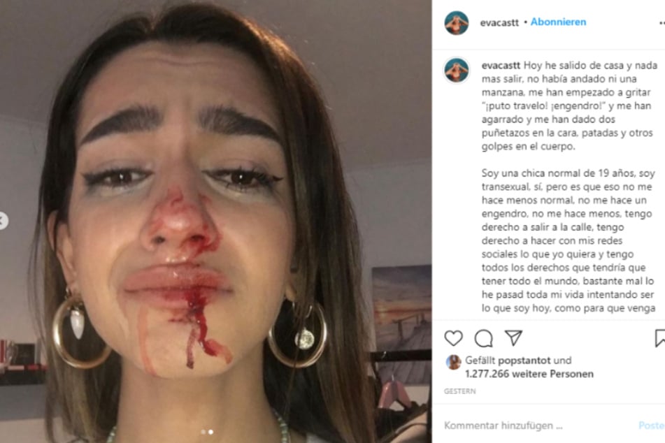 On Instagram, Eva showed her injuries and talked about her attack.
