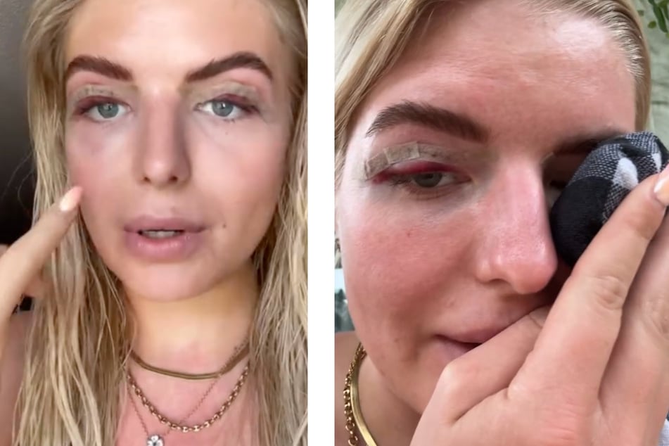 Antonia Hemmer unterzieht sich Beauty-OP: "Meine Augen fühlen sich schwer an!"